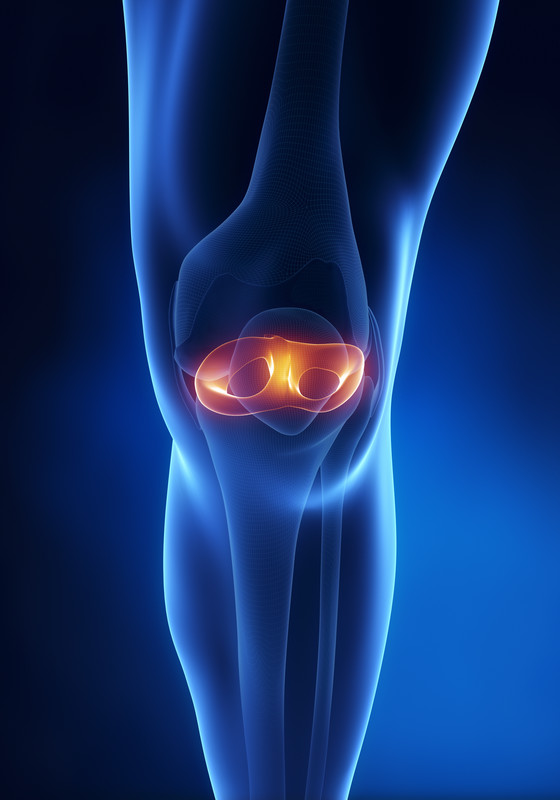 Knee-surgery-schematic